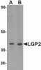 Western blot analysis of LGP2 in MDA-MB-361 cell lysate with LGP2 antibody at (A) 0.5 and (B) 1 &#956;g/mL.