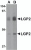 Western blot analysis of LGP2 in rat kidney tissue lysate with LGP2 antibody at (A) 1 and (B) 2 &#956;g/mL.