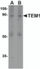 Figure 1 Western Blot Validation in Human Colon Tissue 
Loading: 15 &#956;g of lysates per lane.
Antibodies: TEM-1 4359, (A, 0.5&#956;g/mL; B, 1&#956;g/mL) , 1h incubation at RT in 5% NFDM/TBST.
Secondary: Goat anti-rabbit IgG HRP conjugate at 1:10000 dilution.