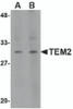 Western blot analysis of TEM2 in human colon tissue lysate with TEM2 antibody at (A) 1 and (B) 2 &#956;g/mL.