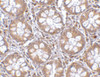 Immunohistochemistry of TEM2 in human colon tissue with TEM2 antibody at 2.5 ug/mL.