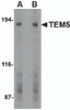 Western blot analysis of TEM5 in human bladder tissue lysate with TEM5 antibody at (A) 2 and (B) 4 &#956;g/mL.