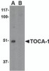 Western blot analysis of TOCA-1 in mouse brain tissue lysate with in (A) the absence and (B) the presence of blocking peptide with TOCA-1 antibody at 1 &#956;g/mL.