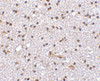 Immunohistochemistry of TOCA-1 in human brain tissue with TOCA-1 antibody at 2.5 ug/mL.