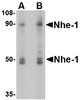 Western blot analysis of Nhe-1 in MOLT4 cell lysate with in with Nhe-1 antibody at (A) 1 and (B) 2 &#956;g/mL.