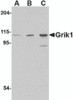 Western blot analysis of Grik1 in P815 cell lysate with Grik1 antibody at (A) 0.5, (B) 1 and (C) 2 &#956;g/mL.