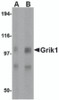 Western blot analysis of Grik1 in rat brain tissue lysate with Grik1 antibody at (A) 0.5 and (B) 1 &#956;g/mL.