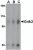 Western blot analysis of Grik2 in human brain tissue lysate with Grik2 antibody at (A) 0.5 and (B) 1 &#956;g/mL.