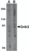 Western blot analysis of Grik3 in human brain tissue lysate with Grik3 antibody at (A) 1 and (B) 2 &#956;g/mL.