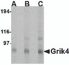 Western blot analysis of Grik4 in Rat brain tissue lysate with Grik4 antibody at (A) 0.5, (B) 1 and (C) 2 &#956;g/mL.