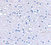 Immunohistochemical staining of human brain tissue using Grik4 antibody at 2.5 ug/mL.