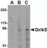 Western blot analysis of Grik5 in human brain tissue lysate with Grik5 antibody at (A) 0.5, (B) 1 and (C) 2 &#956;g/mL.