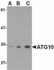 Western blot analysis of ATG10 in SK-N-SH cell lysate with ATG10 antibody at (A) 0.5, (B) 1 and (C) 2 &#956;g/mL.