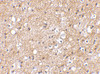 Immunohistochemical staining of human brain tissue using IPR1 antibody at 2.5 ug/mL.