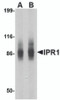 Western blot analysis of IPR1 in SW480 cell lysate with IPR1 antibody at (A) 1 and (B) 2 &#956;g/mL.
