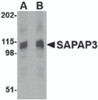 Western blot analysis of SAPAP3 in rat brain tissue lysate with SAPAP3 antibody at (A) 1 (B) 2 &#956;g/mL.