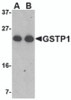 Western blot analysis of GSTP1 in Jurkat cell lysate with GSTP1 antibody at (A) 0.5 and (B) 1 &#956;g/mL.