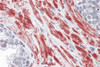 Immunohistochemistry of TBC1D4 in human prostate tissue with TBC1D4 antibody at 10 &#956;g/mL.