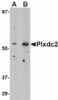 Western blot analysis of Plxdc2 in human brain tissue lysate with Plxdc2 antibody at (A) 0.5 (B) 1 &#956;g/mL.