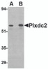 Western blot analysis of Plxdc2 in human colon tissue lysate with Plxdc2 antibody at (A) 0.5 (B) 1 &#956;g/mL.