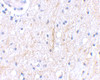 Immunohistochemical staining of human brain tissue using Plxdc2 antibody at 2.5 ug/mL.