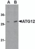 Western blot analysis of ATG12 in human brain tissue lysate with ATG12 antibody at (A) 0.5, and (B) 1 &#956;g/mL.