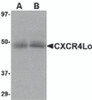 Western blot analysis of CXCR4 in (A) human spleen and (B) human thymus tissue lysate with CXCR4-Lo antibody at 10 &#956;g/mL.