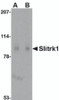 Western blot analysis of Slitrk1 in human brain tissue lysate with Slitrk1 antibody at (A) 1 and (B) 2 &#956;g/mL.