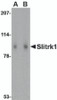 Western blot analysis of Slitrk1 in human brain tissue lysate with Slitrk1 antibody at (A) 1 and (B) 2 &#956;g/mL.