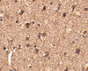 Immunohistochemistry of Slitrk1 in human brain tissue with Slitrk1 antibody at 2.5 ug/mL.
