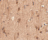 Immunohistochemistry of Slitrk3 in human brain tissue with Slitrk3 antibody at 2.5 ug/mL