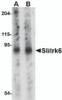 Western blot analysis of Slitrk6 in mouse lung tissue lysate with Slitrk6 antibody at (A) 0.5 and (B) 1 &#956;g/mL.