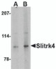 Western blot analysis of Slitrk4 in mouse brain tissue lysate with Slitrk4 antibody at (A) 0.5 and (B) 1 &#956;g/mL.