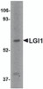 Western blot analysis of LGI1 in HeLa cell lysate with LGI1 antibody at 2 &#956;g/mL.