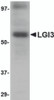 Western blot analysis of LGI3 in human brain tissue lysate with LGI3 antibody at 1 &#956;g/mL.