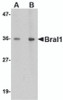 Western blot analysis of BRAL1 in human brain tissue lysate with BRAL1 antibody at (A) 1 and (B) 2 &#956;g/mL.