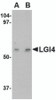 Western blot analysis of LGI4 in human brain tissue lysate with LGI4 antibody at (A) 1 and (B) 2 &#956;g/mL.