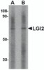 Western blot analysis of LGI2 in mouse liver tissue lysate with LGI2 antibody at (A) 1 and (B) 2 &#956;g/mL.