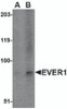Western blot analysis of EVER1 in A-20 cell lysate with EVER1 antibody at (A) 1 and (B) 2 &#956;g/mL.