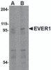 Western blot analysis of EVER1 in human spleen tissue lysate with EVER1 antibody at (A) 1 and (B) 2 &#956;g/mL.
