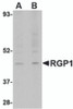 Western blot analysis of RGP1 in human heart tissue lysate with RGP1 antibody at (A) 1 and (B) 2 &#956;g/mL.