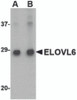 Western blot analysis of ELOVL6 in Human brain tissue lysate with ELOVL6 antibody at (A) 1 and (B) 2 &#956;g/mL.