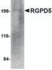 Western blot analysis of RGPD5 in human thymus tissue lysate with RGPD5 antibody at 1 &#956;g/mL.