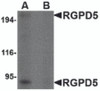 Western blot analysis of RGPD5 in human thymus tissue lysate with RGPD5 antibody at 1 &#956;g/mL in (A) the absence and (B) the presense of blocking peptide.