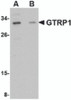 Western blot analysis of GRTP1 in SK-N-SH cell lysate with GRTP1 antibody at 1 &#956;g/mL in the (A) absence and (B) presence of blocking peptide.