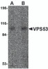 Western blot analysis of VPS53 in 293 cell lysate with VPS53 antibody at (A) 0.5 and (B) 1 &#956;g/mL.