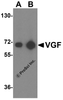Western blot analysis of VGF expression in human brain tissue lysate with VGF antibody at (A) 1 and (B) 2 &#956;g/ml.