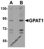 Western blot analysis of GPAT1 in rat brain tissue lysate with GPAT1 antibody at (A) 1 and (B) 2 &#956;g/mL.