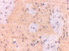 Immunohistochemistry of GPAT1 in rat brain with GPAT1 antibody at 2.5 ug/mL.