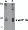 Western blot analysis of Wnt10b in human skeletal muscle tissue lysate with Wnt10b antibody at (A) 2 and (B) 4 &#956;g/mL.